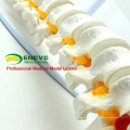 SPINE01 (12372) Medical Science Nature Classic Flexible Spine Model without Pelvis , Spine/Vertebrae Models > Life-Size Spine